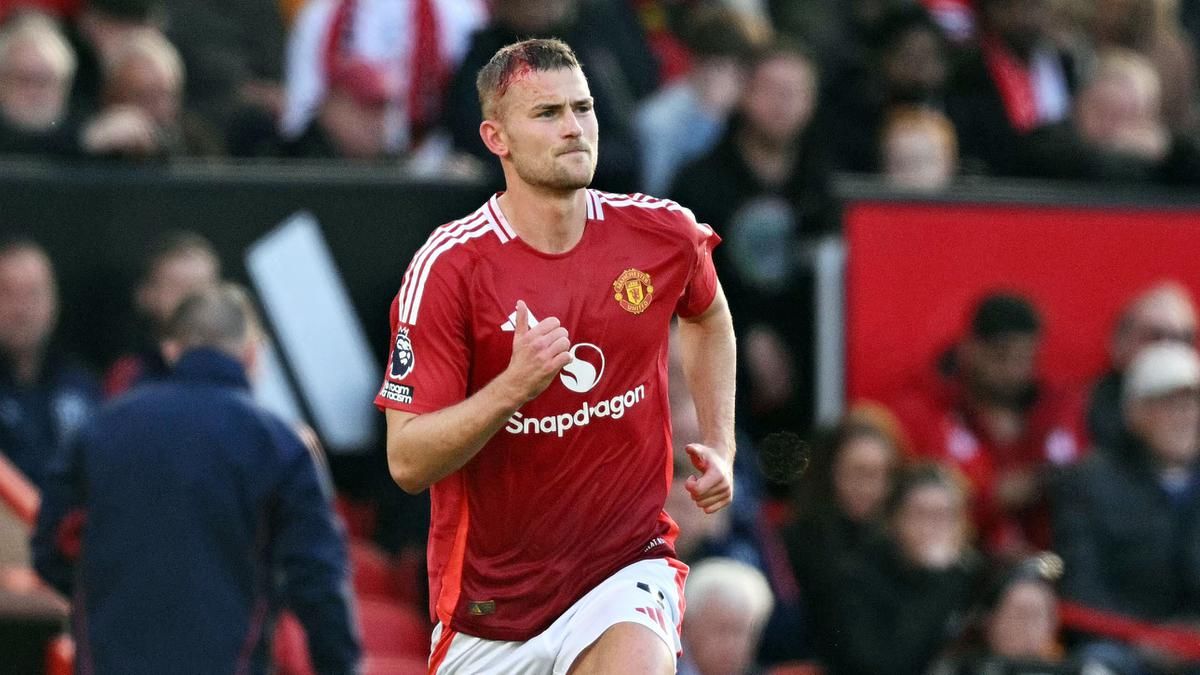 De Ligt Terus Bergelut dengan Cedera Punggung, Kapan Kembali?