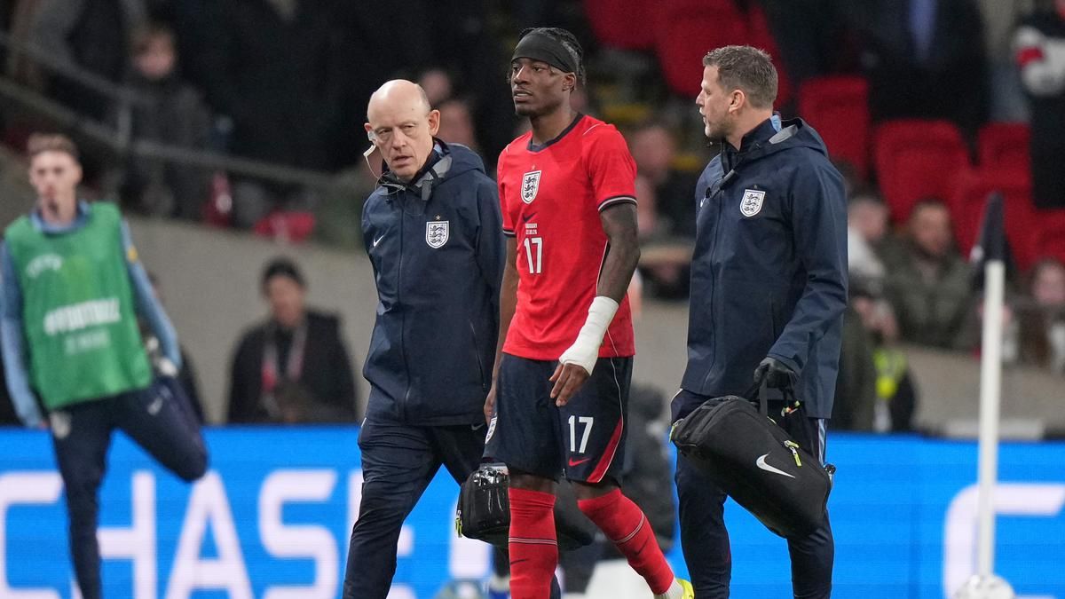 Noni Madueke Arsenal Cedera Saat Bela Timnas Inggris